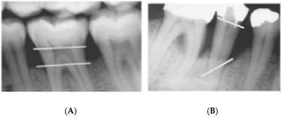 Dentistry 09 00019 g003 550