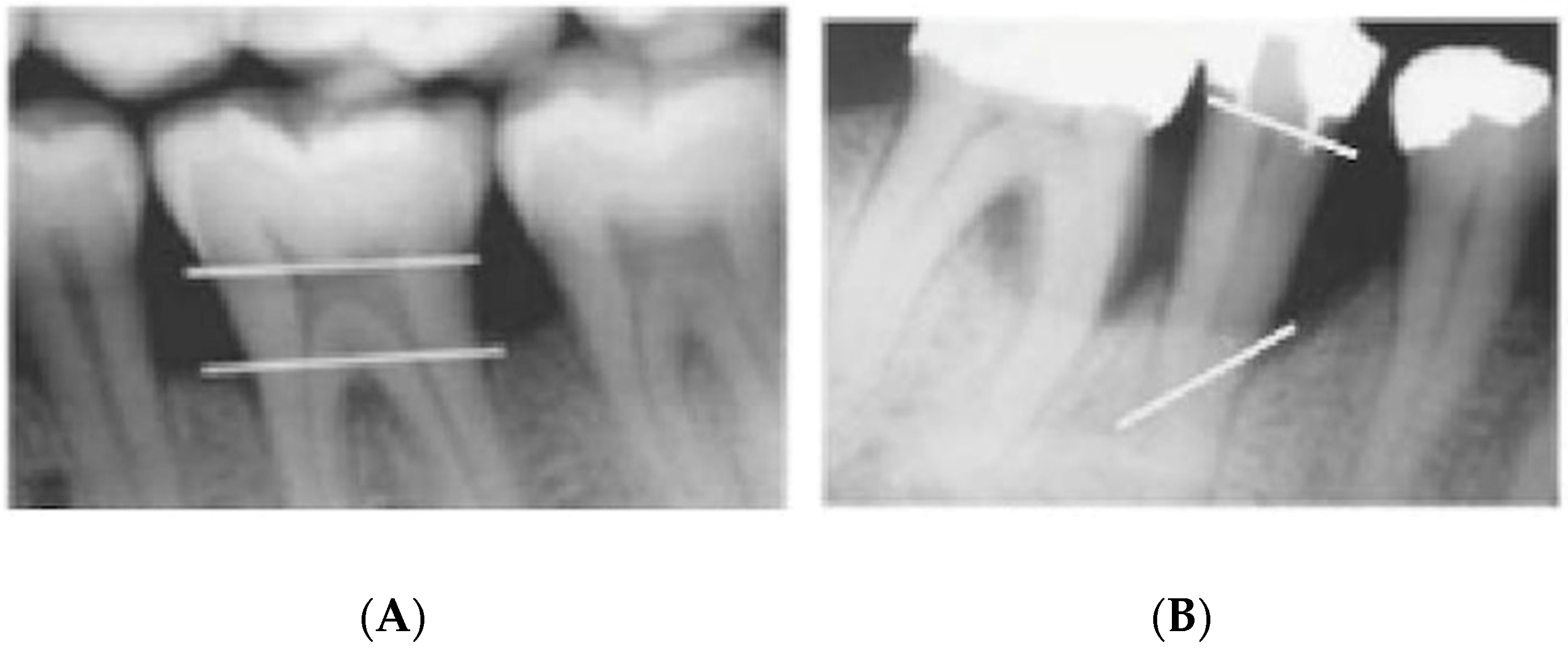 Dentistry 09 00019 g003